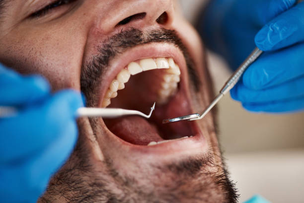 Best Emergency Denture Repair in Morgantown, KY